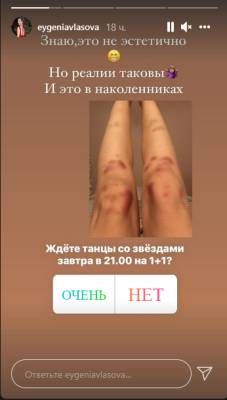 Леонов сделал заявление о состоянии после ДТП, а Власова показала серьезные травмы на "Танцах со звездами"