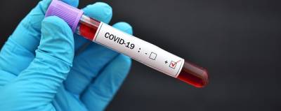 Как лечить COVID-19 дома: что делать, если заразился, но ехать в больницу необходимости нет