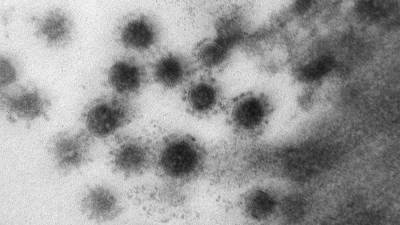 Врачи обнаружили новый "дельта"-штамм коронавируса в Москве