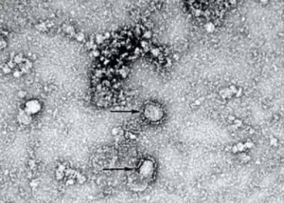 Дельта-штамм коронавируса изменяется в 200 раз быстрее вируса оспы - Роспотребнадзор