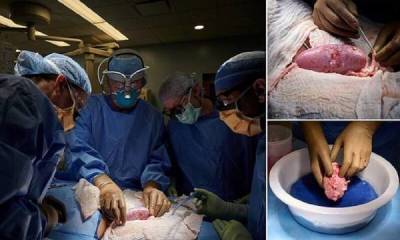 Хирурги успешно пересадили человеку почки свиньи