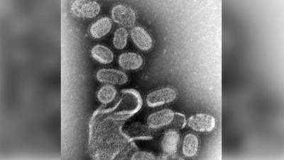 Штамм гриппа В/Yamagata мог полностью исчезнуть на фоне пандемии коронавируса