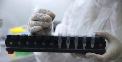 В Беларуси переходят на активное использование тестов на антиген к коронавирусу - это более дешевая и быстра альтернатива ПЦР-тестам