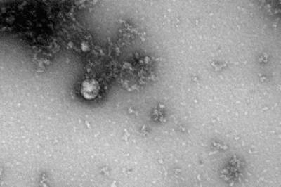 Эксперт Центра Гамалеи оценил опасность нового штамма коронавируса AY.4.2