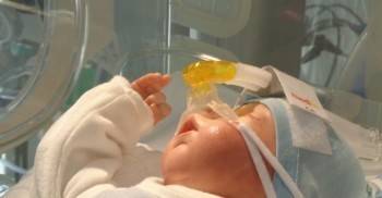 Появились подробности о состоянии младенца, заболевшего COVID-19 в Вологодской области