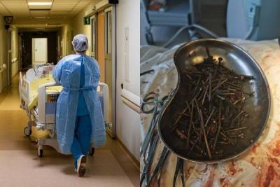 Уникальная операция в Литве: из желудка литовца извлекли килограмм гвоздей и шурупов