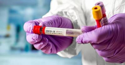 В Украине выявили за сутки более 17 тысяч человек, заболевших коронавирусом