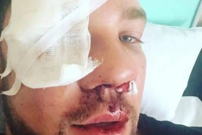 Избитый тремя дагестанцами в метро россиянин показал фото из больницы
