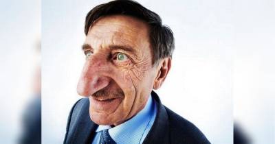Житель Туреччини визнаний власником найдовшого у світі носа