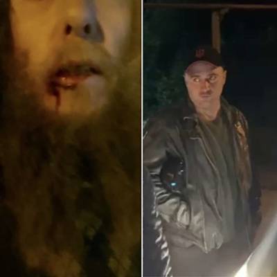 Пьяный украинец избил хасида в Умани