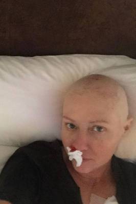 Шэннен Доэрти рассказала о борьбе с последней стадией рака: «Это некрасиво, но правдиво»