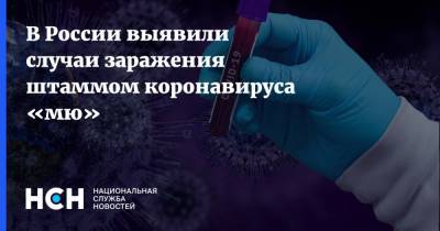 В России выявили случаи заражения штаммом коронавируса «мю»