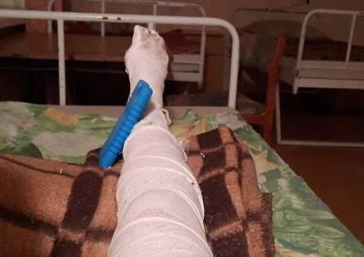 В Рязани беременная женщина сломала ногу при выходе из маршрутки