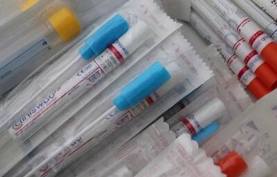 «Бесплатные» ПЦР-тесты на коронавирус могут оказаться уловкой мошенников