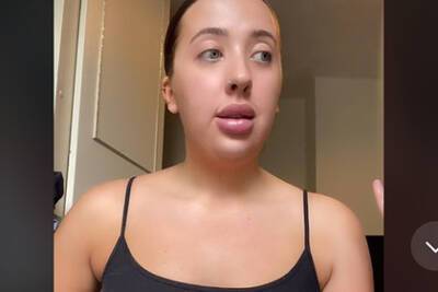 Девушка избавилась от пухлых губ после 4 лет инъекций и показала результат