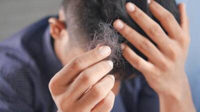 Российский врач назвала способы остановить выпадение волос после COVID-19
