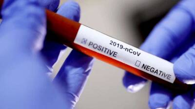 Власти Германии возвращают бесплатное тестирование населения на коронавирус