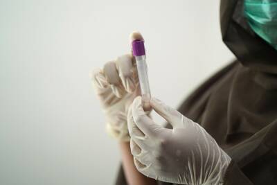 577 новых фактов заражения коронавирусом выявили медики в Смоленской области