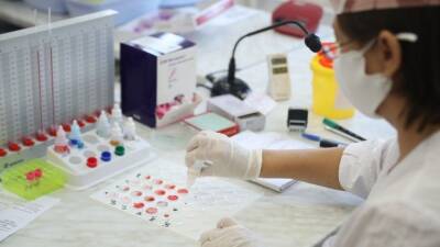 В Росздавнадзоре призвали стандартизировать подсчет антител к COVID-19 по школе ВОЗ
