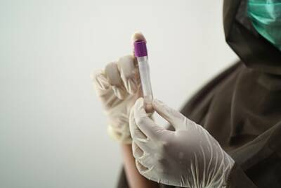 Российские медики пересчитают антитела к коронавирусу