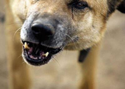 На Ямале пострадавшие от нападения бродячих собак дети получат компенсацию