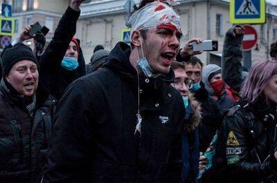 Эхо митингов «за Навального». Подростку с измазанной краской бинтом дали 4,5 года колонии