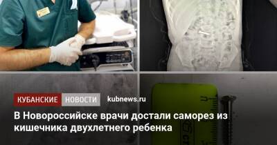В Новороссийске врачи достали саморез из кишечника двухлетнего ребенка