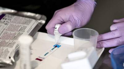 Ученый прокомментировал второй случай естественного излечения человека от ВИЧ