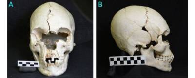 На Карибских островах найден череп древнейшего прокаженного человека Америки