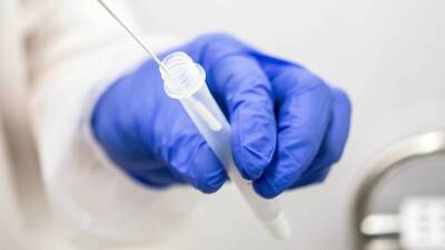 Роспотребнадзор увеличит охват тестирования граждан на коронавирус