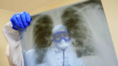 Сергей Пурясев - Пульмонологи рассказали, как определить состояние лёгких при COVID-19 - russian.rt.com