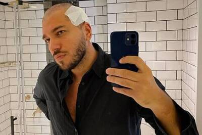 Блогер Павел Бобров рассказал о пересадке волос. В телеграм-каналах восхитились его открытостью