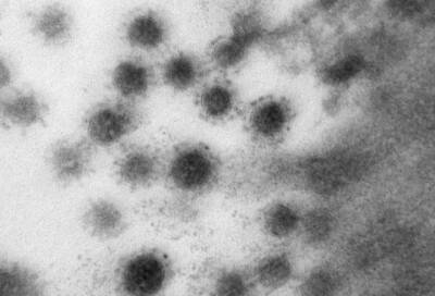Ученые показали, как выглядит на фото дельта-коронавирус