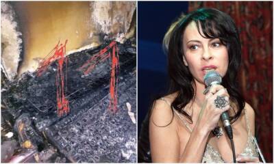 Певица Марина Хлебникова в коме: у нее более 50% ожогов тела