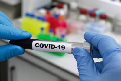 В Новгородской области COVID-19 диагностировали еще у 332 человек