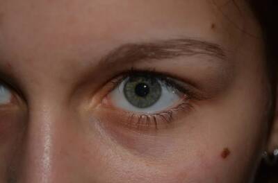 Офтальмолог рассказала, что делать при появлении синдрома «сухого глаза»