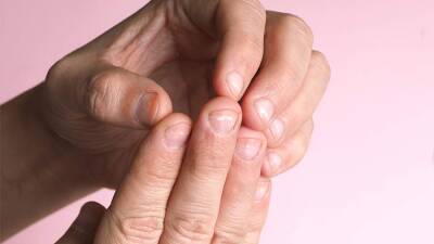 Дерматолог назвала неочевидные причины белых пятен на ногтях