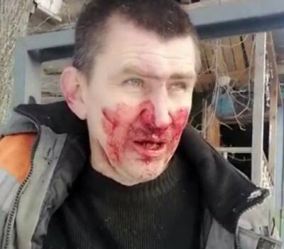В Кузбассе экоактивиста избили приехавшие с экс-депутатом мужчины