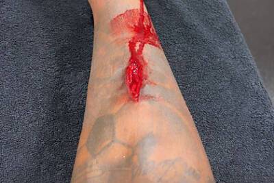 Футболист «Зенита» показал фото окровавленной ноги после заработанного пенальти