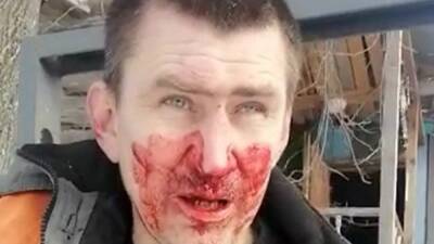 Кузбасского экоактивиста избили в присутствии бывшего депутата