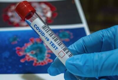 Медик Токарев рассказал, кто имеет право бесплатно пройти тестирование на коронавирус