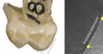 Зубная фея раннего палеолита. Археологи нашли молочный зуб ребенка, жившего 120 тыс. лет назад