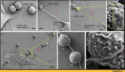 Раковые клетки пойманы на воровстве митохондрий «щупальцами» — ученые