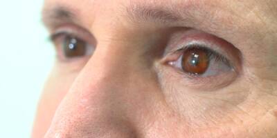 Британские медики впервые пересадили человеку напечатанный на 3D-принтере глаз