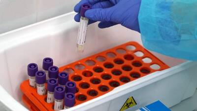 В Чехии выявили новый штамм коронавируса «Омикрон»