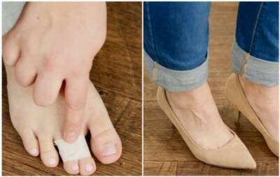 9 лайфхаков, которые помогут быстро решить проблемы с неудобной обувью