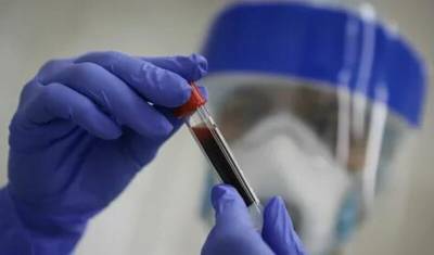 Американские ученые обнаружили антитело, способное противостоять коронавирусам