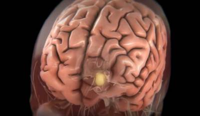 Ученые выяснили, что коронавирус не поражает клетки мозга