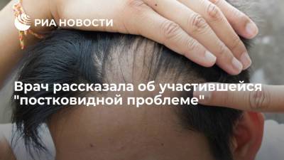 Врач Климкина рассказала, что пациенты все чаще жалуются на выпадение волос после COVID-19