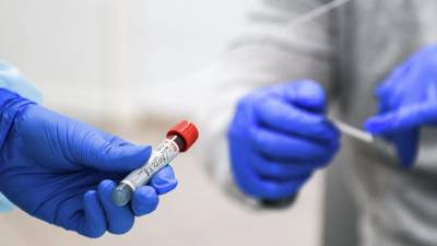 В Кировской области зарегистрировали 290 случаев коронавируса за сутки